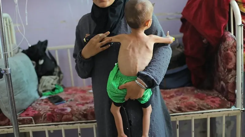 Gazze'de Açlık Felaketi! 8 Filistinli Daha Hayatını Kaybetti