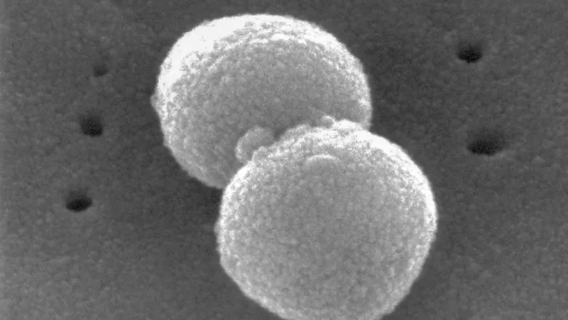 Süper bakteriye karşı geliştirilen antibiyotik, testlerin son aşamasına girdi